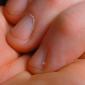 Почему появляются заусенцы на пальцах и как от них избавиться Как залечить заусенцы
