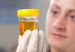 Analiza urina pri psih: norma in patologija
