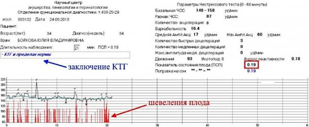 Daje plodu kgg.  CTG med nosečnostjo: kako to počnejo, kaj kaže slab CTG