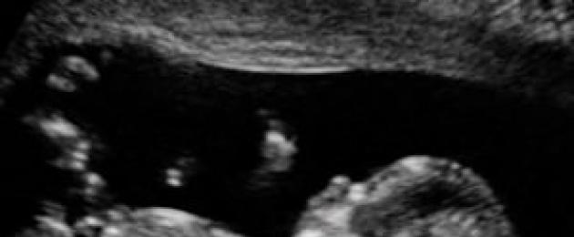3 ultrazvočne predstave.  Tretji ultrazvok med nosečnostjo: najpomembnejši kazalci in čas