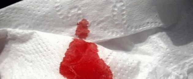 Menstruācijas nāca un tad grūtniecība.  Vai menstruācijas un ieņemšana ir savstarpēji izslēdzošas?