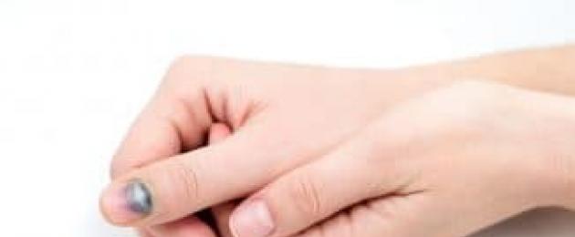 Вмятины и ямки на ногтях: причины, лечение. Вмятины на ногтях рук? Крошатся ногти на руках? Давайте разберемся Дырки на ногтях рук причины