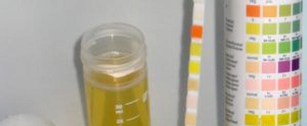 Splošna analiza urina med nosečnostjo in njena razlaga.  Ploščati epitelij v preiskavah urina pri nosečnicah Kot dokazuje ledvični epitelij
