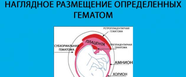 Kako zdraviti hematom med nosečnostjo.  Vzroki in zdravljenje različnih hematomov v zgodnji nosečnosti