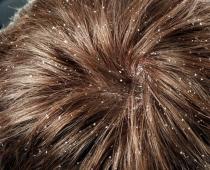 Kāpēc sāp galvas āda Nervu procesus ietekmējošas patoloģijas