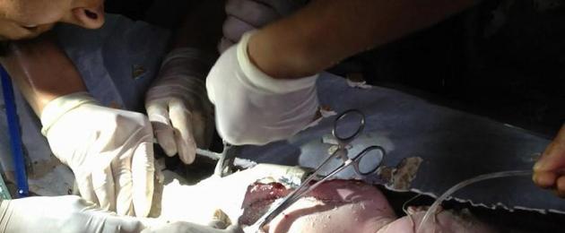 Novorozená holčička plakala v márnici při rozchodu.  Incredible Baby Survival Stories (7 obrázků)