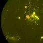 Kokiu mikroskopu galima pamatyti bakterijas