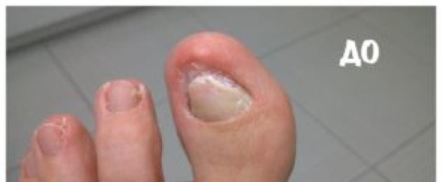 Lidé s velmi dlouhými nehty.  Nejdelší nehty na světě: nový Guinnessův rekord