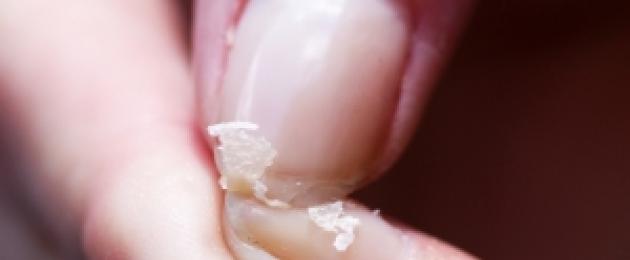 Lámavé nehty, odstranění lámavosti nehtů.  Proč potřebujete překrýt nehty biogelem Jak nalakovat nehty, aby se nelámaly